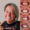 smile-makeover-0045